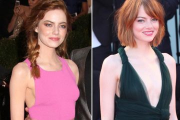 Best and Worst Celebrity Transformations