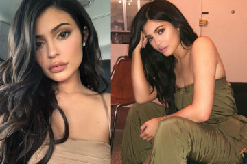 Did Kylie Jenner get Plastic Surgery AGAIN?!