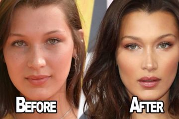 Bella Hadid OPENS UP about having Plastic Surgery!